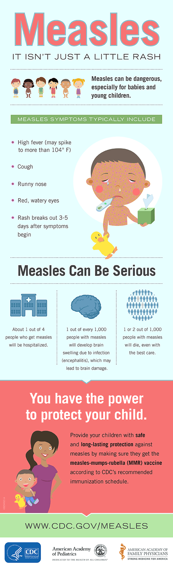 measles