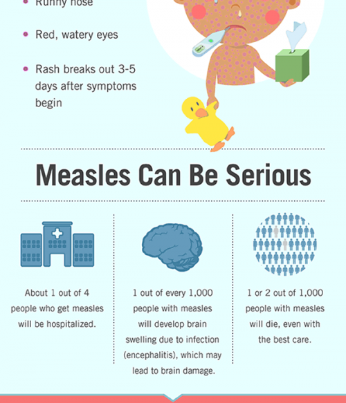 measles